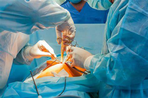 Image: Oncoplastische borstoperatie