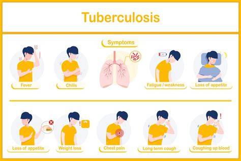 Infographic “wat je moet weten over tuberculose” en postermateriaal
