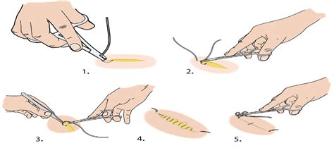 Gedetailleerde illustratie van de statische hechting van een badkamer mand, met nadruk op de rubberen plug en het statische principe.