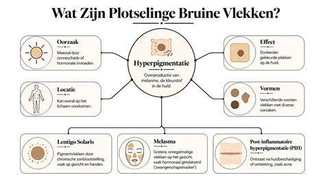 Infographic: Oorzaken van vlekken en hoe te voorkomen