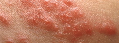 Illustratie van blaasjes in verf