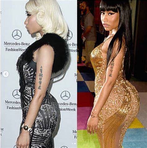 Infographic: Overzicht van mogelijke cosmetische ingrepen bij Nicki Minaj Before After (BBL, rhinoplastie, fillers)