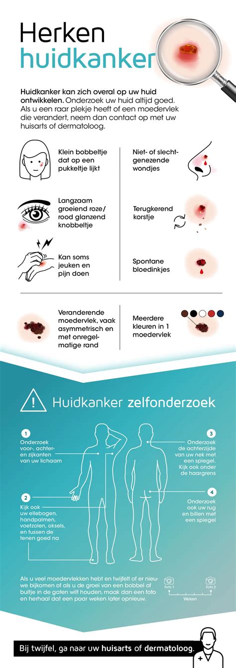 Infographic met symptomen van verschillende soorten conjunctivitis