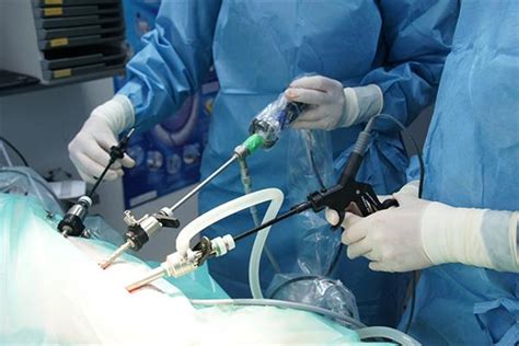 Schema van de laparoscopische sterilisatie met clips.