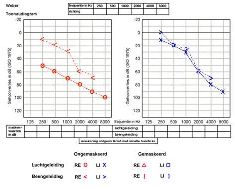Grafiek: LUFS-benchmarking voor spraak vs muziek