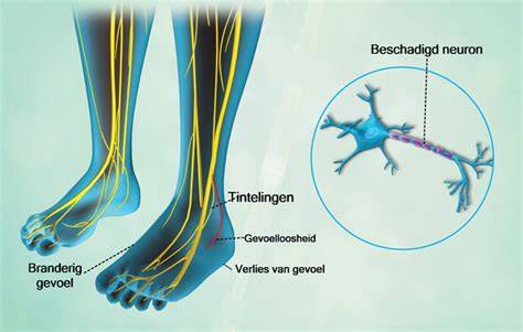 Infographic: Stappen in het zorgpad genetische perifere neuropathie