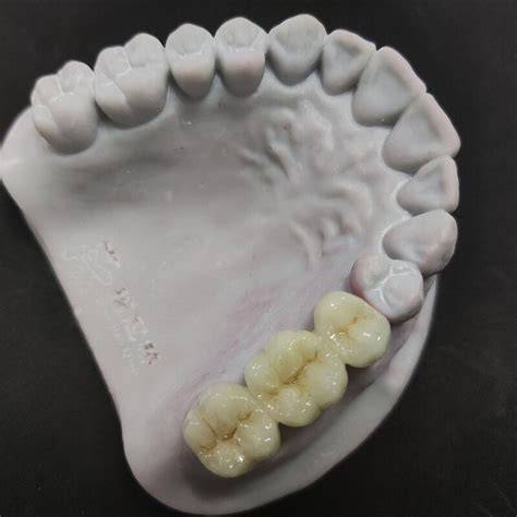 Visual: Drum en toner-instellingen bij laserprinten