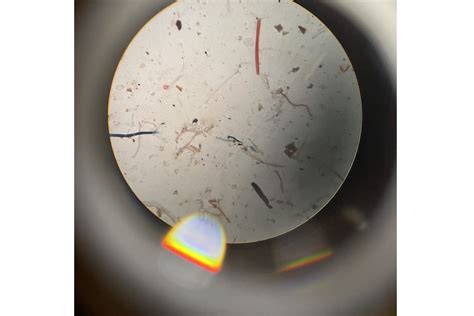 Illustratie van asbestvezels onder een microscoop