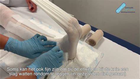 Handleiding: verzorging van gips en maatregelen tegen zwelling