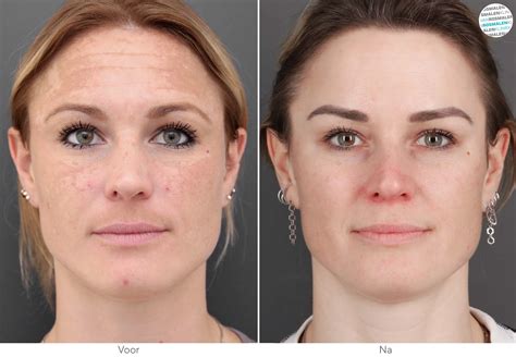 voor-en-na foto van badkamervoegen na behandeling met cola