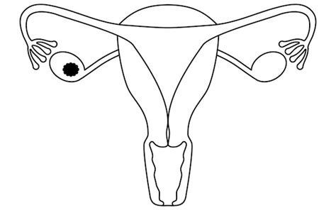 Diagrammatische weergave van vul- en schuurstappen