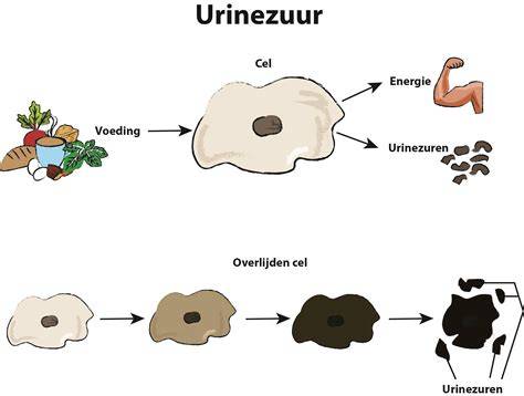 Infographic over factoren die urinezuur beïnvloeden en stappen om het te verlagen