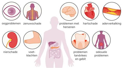 Infographic: Operatieopties voor rughernia en mogelijke complicaties