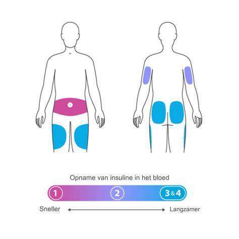 Infographic: overzicht waterkering, overbrugging en injecteren