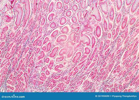 Beeld van amosietvezels onder de microscoop