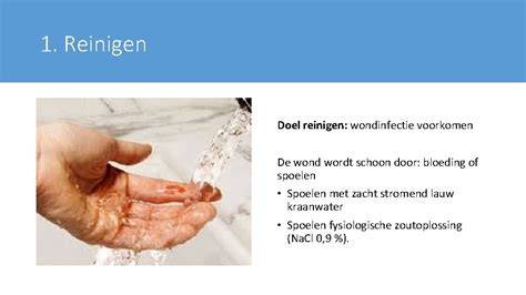 illustratie: spoelen van een wond onder de kraan