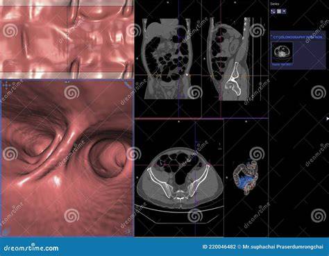 Diagrammatische weergave van scan- en 3D-reproductie van ornamenten