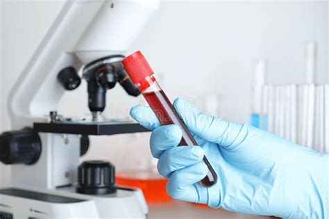 Afbeelding: Laboratoriumanalyse van asbestmonsters