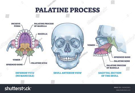 Diagram: plaatsingsopties Palatino (recht vs diagonaal)