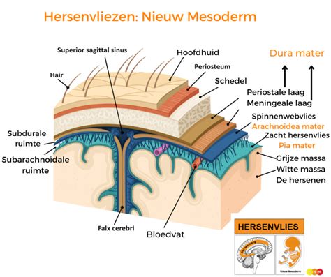 Diagram: Beschermlagen en glansgradaties