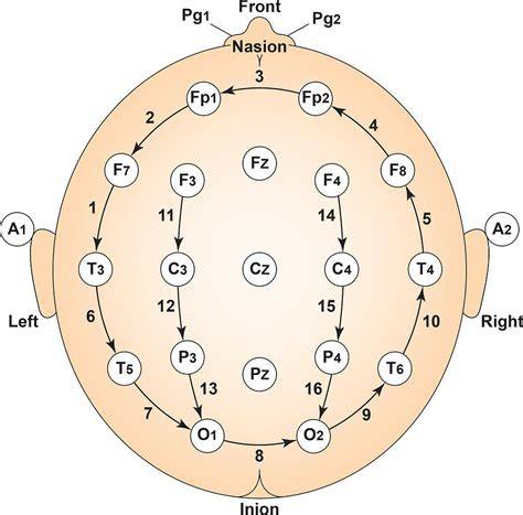 GoUp montage diagram