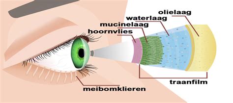 Illustratie die de verschillende lagen van de traanfilm toont en factoren die droge ogen veroorzaken.