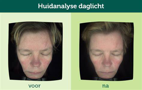 Gerealiseerde houtrotrestauratie: voor- en nafoto’s