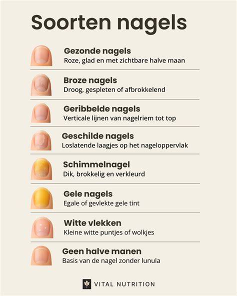 Informatieve afbeelding: overzicht van dakleien en nagels