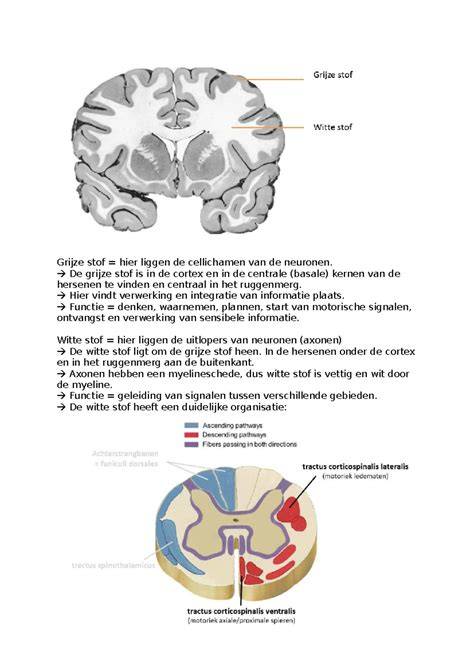 infographic keuzes witte en grijze voorstrijk