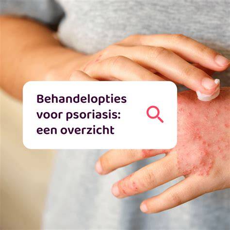 Infographic: overzicht behandelopties voor huidversteviging