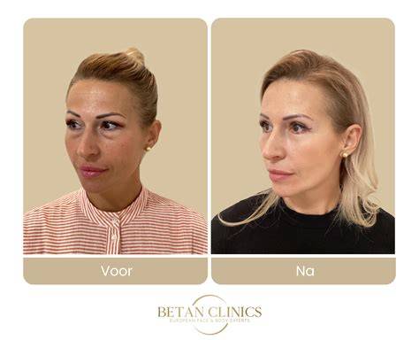 Foto-impressie: voor en na professionele bestratingsreiniging
