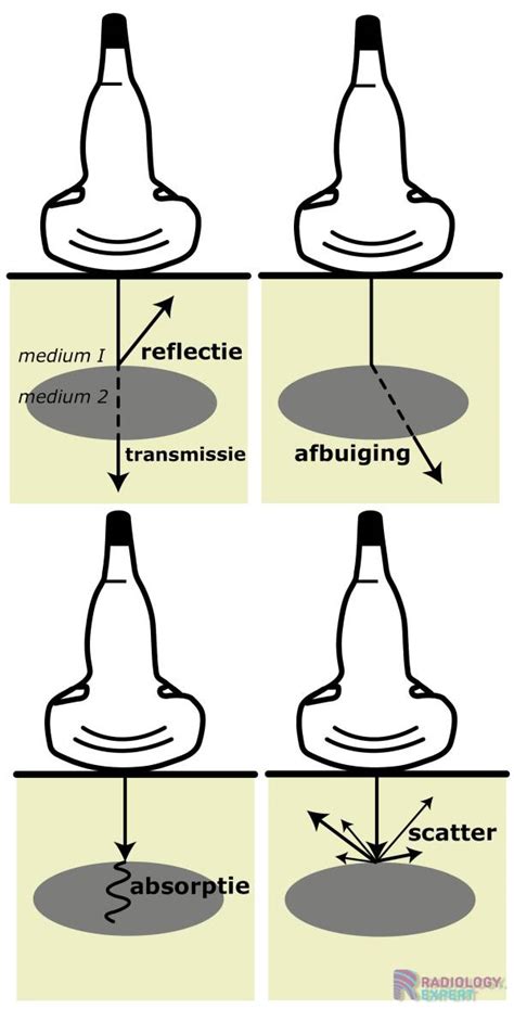Infographic: Massa-veer-massaprincipe en absorptie