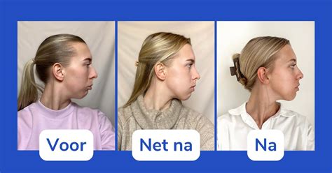 Voor-en-na foto's van geverfde keukenfronten.